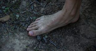 asam urat menyebabkan kaki mati rasa
