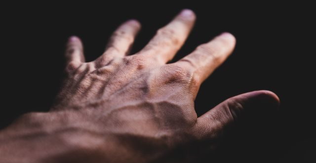 Proses pembentukan kristal akibat kadar asam urat dan ginjal yang mengalami gangguan penyaringan