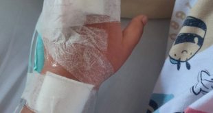 bahaya kolesterol yang menumpuk dan menyumbat pembuluh darah jantung dan otak